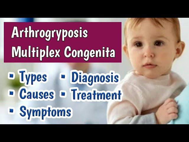 Arthrogryposis Management Market Report 2024: Key Insights and Industry Outlook