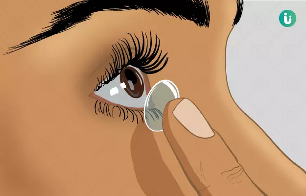 Global Therapeutic Contact Lenses Market